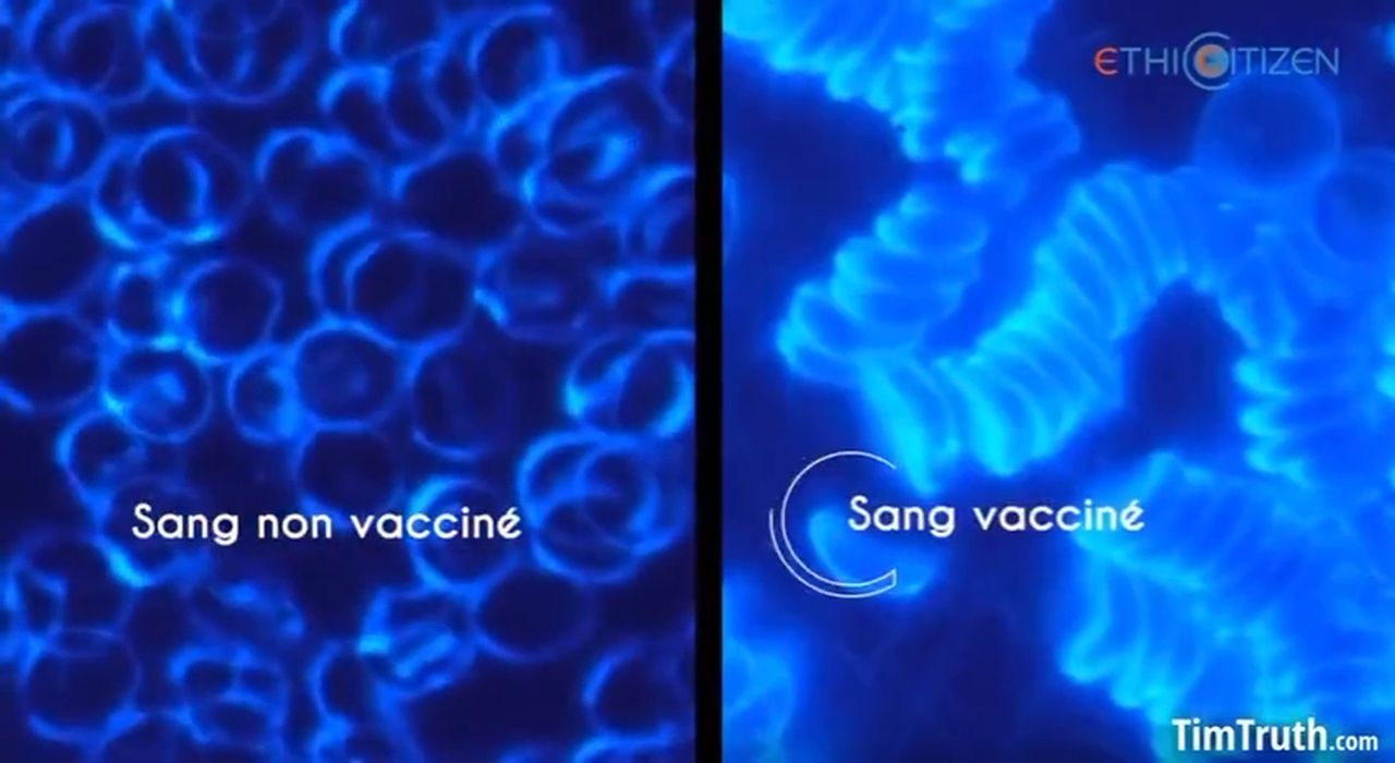 Červené krvinky neočkované a očkované osoby
